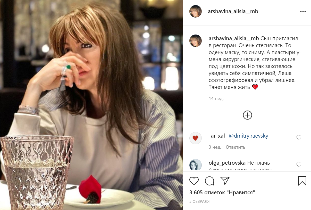 Потерявшая нос экс-жена Аршавина готовится к трем новым операциям
