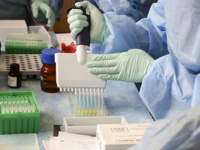 Жителей Мурманской области предупредили о высоких рисках заражения норовирусом